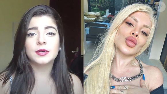 Antes e depois de Gkay: a influenciadora também foi detonada por ter exagerado nos preenchedores, mas removeu boa parte deles