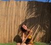 Atualmente com 27 anos, Sasha tem alergia a carne vermelha e segue uma dieta vegana há um bom tempo