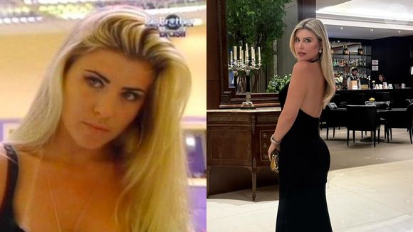 Antes e depois de Íris Stefanelli: uma das favoritas do 'BBB 7' e protagonista de um triângulo amoroso, a famosa revolucionou sua beleza com a estética