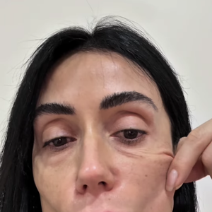 Michelle Barros chegou a gravar um vídeo mostrando a flacidez da pele do seu rosto, mas logo mudou novamente