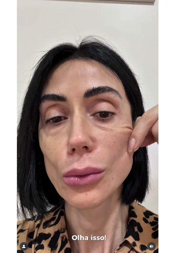 Michelle Barros chegou a gravar um vídeo mostrando a flacidez da pele do seu rosto, mas logo mudou novamente