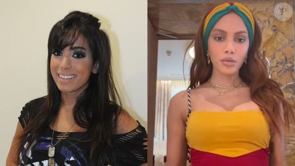 Antes e depois de Anitta: mais recentemente, cantora transformou seu rosto mais uma vez e causou na web