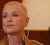 Com a mesma doença de Maiara, Xuxa revela motivo crucial para fazer transplante capilar: 'Estava me sentindo mal'