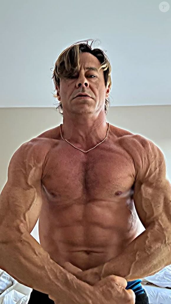 Theo Becker afirma que levou um soco da modelo por conta de uma crise de ciúme