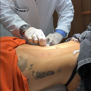 Virginia Fonseca mexeu no bumbum, rosto e abdômen em procedimento pós-Natal 2024