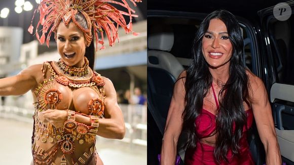 Antes e depois de Gracyanne Barbosa: procedimentos estéticos transformaram o rosto da atriz, que retirou parte dos preenchimentos