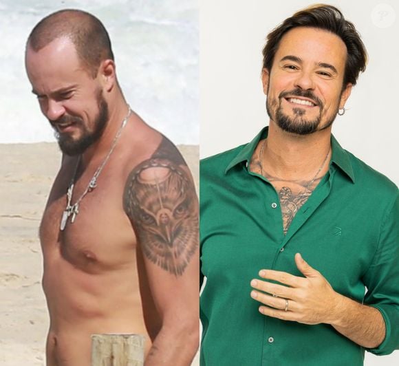 Paulo Vilhena foi um dos primeiros famosos a passar pelo transplante capilar