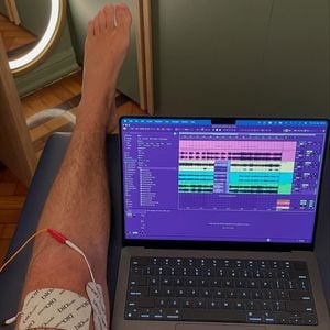 Felipe Poeta revelou que ainda faz 3 sessões de fisioterapia por dia, mas que já está muito melhor e consegue se locomover bem