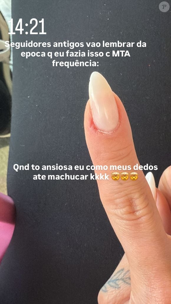 Virgínia Fonseca fez uma publicação em seus stories revelando que voltou a 'comer os dedos' devido a uma crise de ansiedade