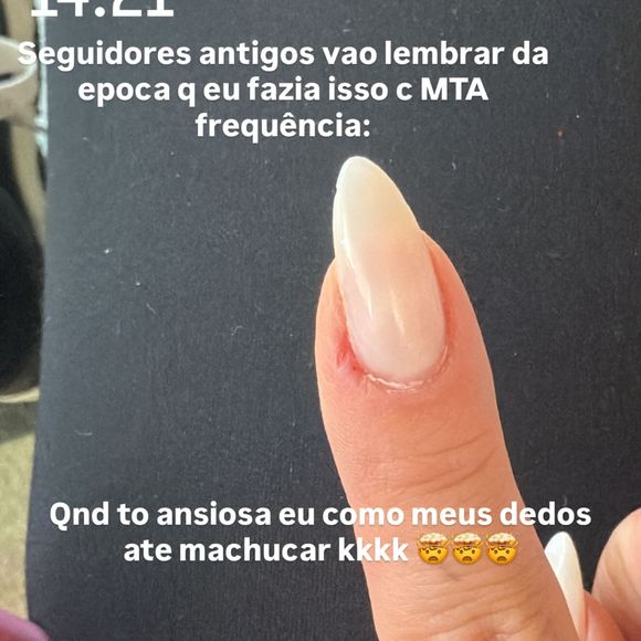 Virgínia Fonseca fez uma publicação em seus stories revelando que voltou a 'comer os dedos' devido a uma crise de ansiedade