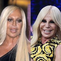Donatella Versace antes e depois: 36 anos separam essas transformações absurdas no rosto da famosa - e você vai se chocar com 50 fotos