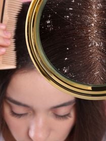 Esqueça a caspa no verão: é verdade que lavar o cabelo todo dia piora a doença? Veja o que dizem especialistas!