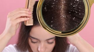 Esqueça a caspa no verão: é verdade que lavar o cabelo todo dia piora a doença? Veja o que dizem especialistas!