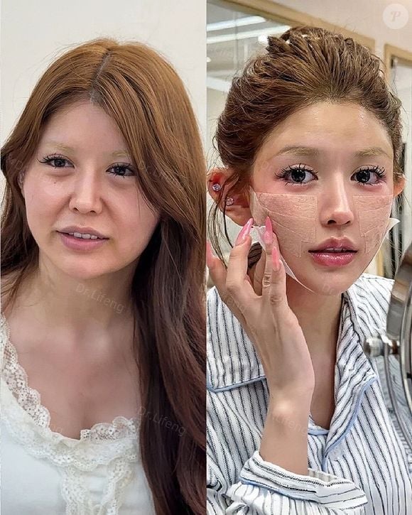 Como Dr. Lifeng promete, seus pacientes rejuvenescem 20 anos