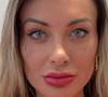 Além dos olhos, como fizeram Andressa Urach e Maya Massafera: quais outros procedimentos estéticos mudam a cor do corpo?
