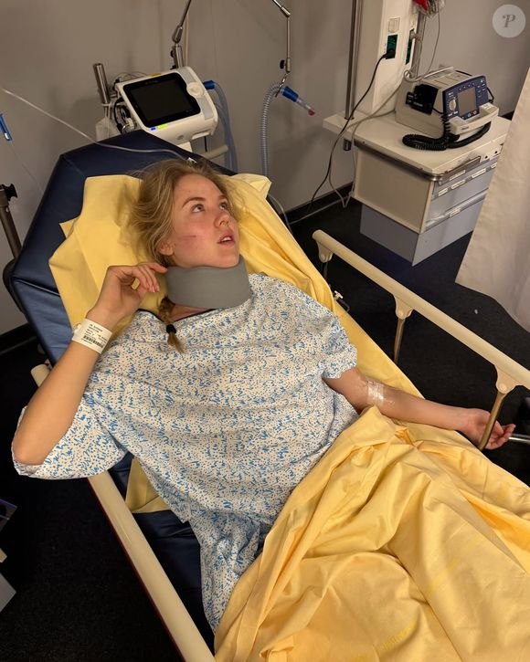 A filha de 21 anos do príncipe Carlo, duque de Castro, e da princesa Camilla, duquesa de Castro, usou seu Instagram nesta semana para informar seus seguidores sobre o ocorrido e pedir que tenham segurança ao pilotar uma motocicleta.