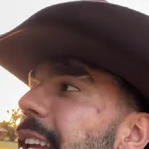 Luan Pereira não revelou se o hematoma foi causado pela briga com Dado Dolabella