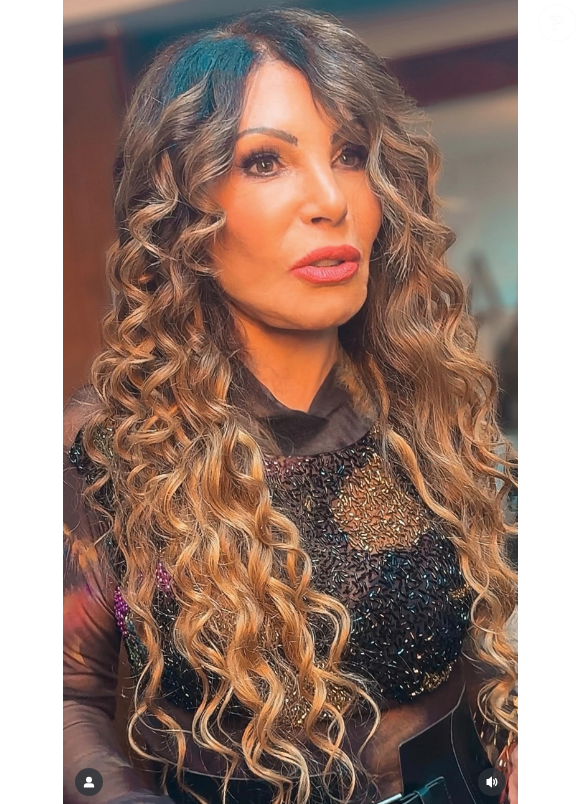 Roosevelt Lewis, especialista em estética e harmonização facial, indicou que possíveis procedimentos feitos por Elba teriam sido a harmonização e bioestímulo de colágeno