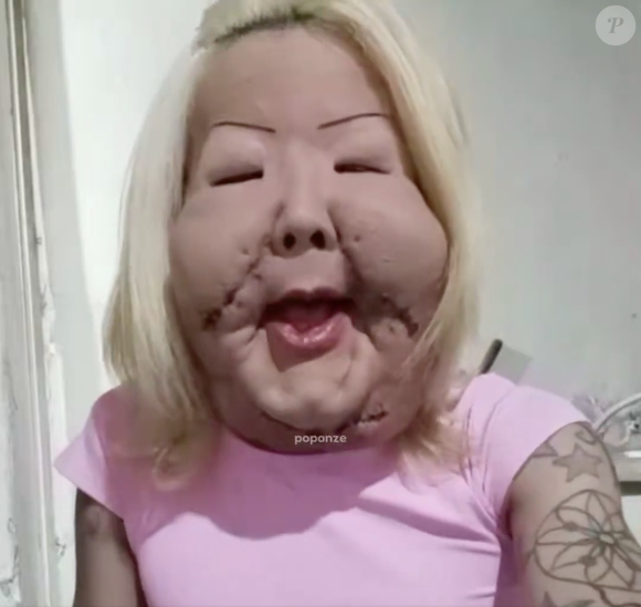 Com as cicatrizes aparentes e ainda com os pontos, Juju do Pix agradeceu ao médico e disse estar confiante