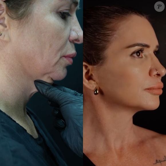 Antes e depois de Viviane Tube impressionou em um vídeo publicado em seu perfil do Instagram