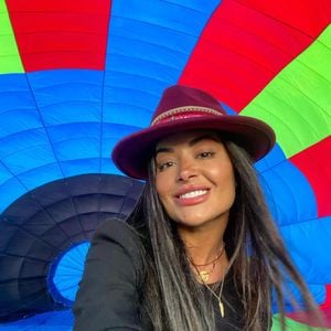 Uma das principais transformações de Aline Campos veio com uma harmonização facial