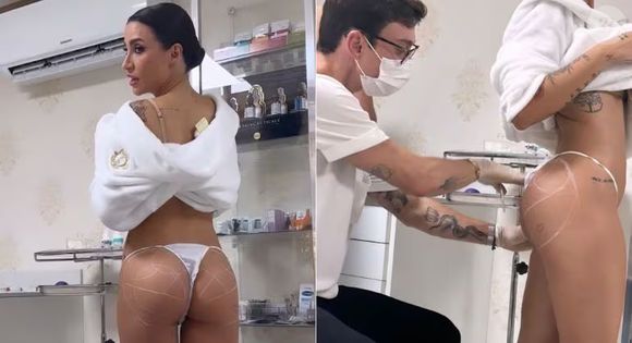 Bianca Andrade exibe como era o bumbum antes da harmonização