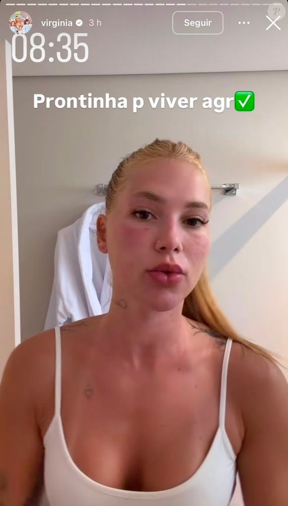 Virginia Fonseca mostrou aos seguidores como ficou seu rosto após passar por tratamento a laser