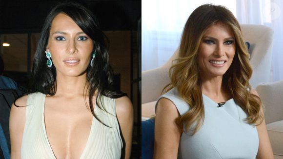 Entre os possíveis procedimentos de Melania Trump estão a rinoplastia, bichectomia, aplicação de botox, preenchimento labial e uso de lasers na pele