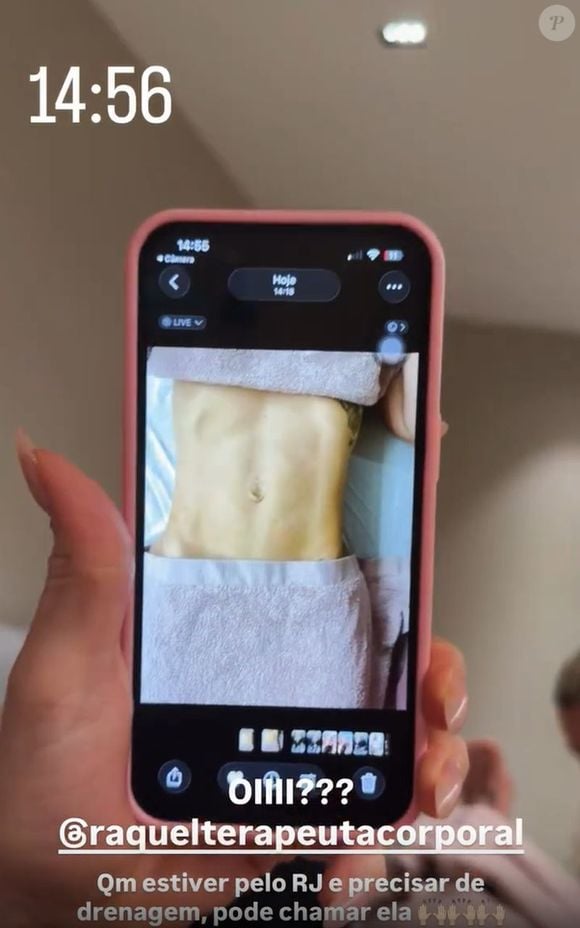 Virgínia Fonseca também é adepta dos procedimentos estéticos