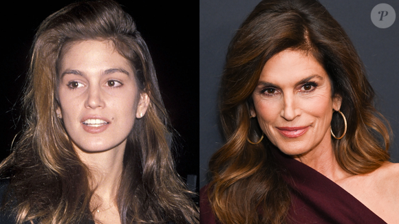 O relato de Cindy Crawford reacendeu o debate sobre os cuidados com as pálpebras e a importância de tratamentos personalizados para essa região delicada do rosto