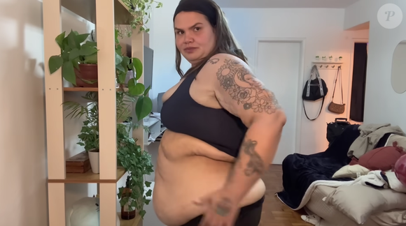 Thais Carla revelou que pretende fazer cirurgias para a remoção do excesso de pele