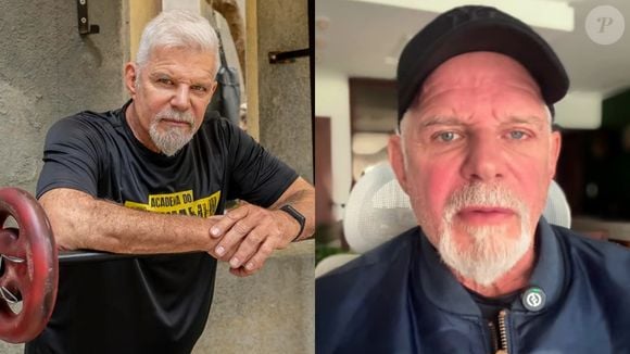 Antes e depois de Raul Gazolla: o ator passou por harmonização facial em 2022 aos 66 anos