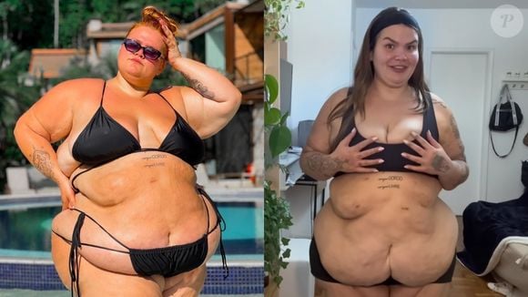 Thais Carla antes e depois: influenciadora mostra corpo após perder 72 kg com bariátrica e resultado choca a web. 'Rejuvenesceu 1000 anos'