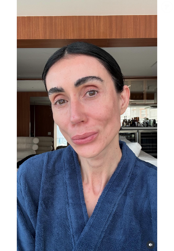 Michelle Barros também fez uma blefaroplastia para remover o excesso de pele nas pálpebras