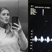 Aos 32 anos, influenciadora Niina Secrets revela perda do bebê após poucas semanas de gravidez e desabafa: 'É muito difícil fingir que está tudo bem'