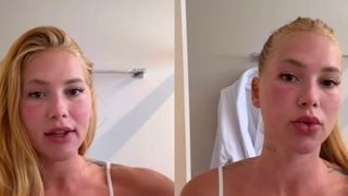 'Ia fazer um lifting, mas como eu vou viajar, vou...': aos 27 anos, Virginia Fonseca surge com rosto inchado e explica aparência diferente após novo procedimento estético