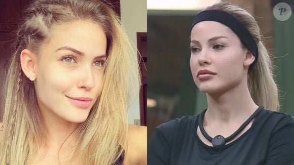 Antes e depois de Saory Cardoso: a influenciadora foi mais uma que apostou em preenchimentos para harmonizar seu visual