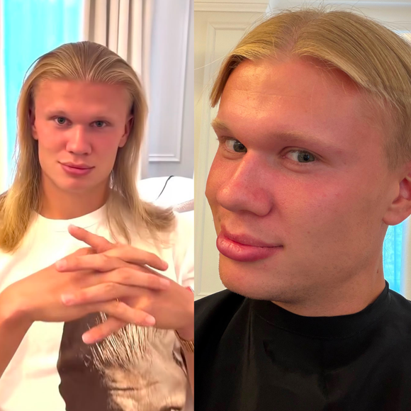 Adeus ao cabelo de viking! Haaland muda visual após Copa 2026, surpreende Bellingham e ganha reação de Vini Jr.; veja fotos
