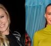 Antes e depois de Ana Paula Siebert: esposa de Roberto Justus é mais uma que apostou em procedimentos e ficou irreconhecível