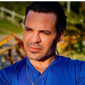 Eduardo Costa foi acusado de usar e abusar de procedimentos estéticos