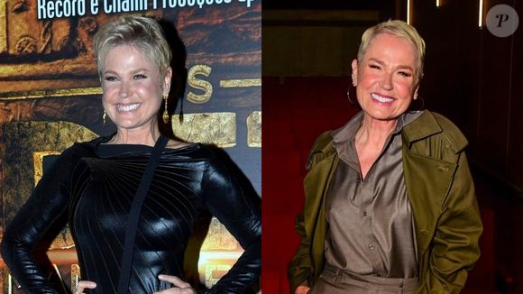 Antes e depois de Xuxa: apresentadora renovou seu visual com um transplante capilar e procedimentos estéticos