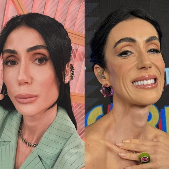 Antes e depois de Michelle Barros: jornalista de 'A Fazenda' mudou MUITO após remover preenchimentos e fazer lifting facial