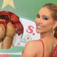 O que é real e o que é estética no bumbum de Virgínia? Especialista entrega segredos do treino das famosas para o Carnaval: 'Procedimentos não substituem'