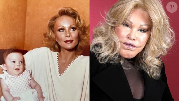 Antes e depois de Jocelyn Wildenstein: um dos casos mais citados quando falamos em celebridades que ficaram irreconhecíveis, socialite morreu em 2024