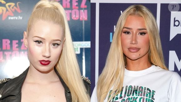 Antes e depois de Iggy Azalea: a rapper é a prova de que, quando bem feitas, as plásticas deixam o visual impecável