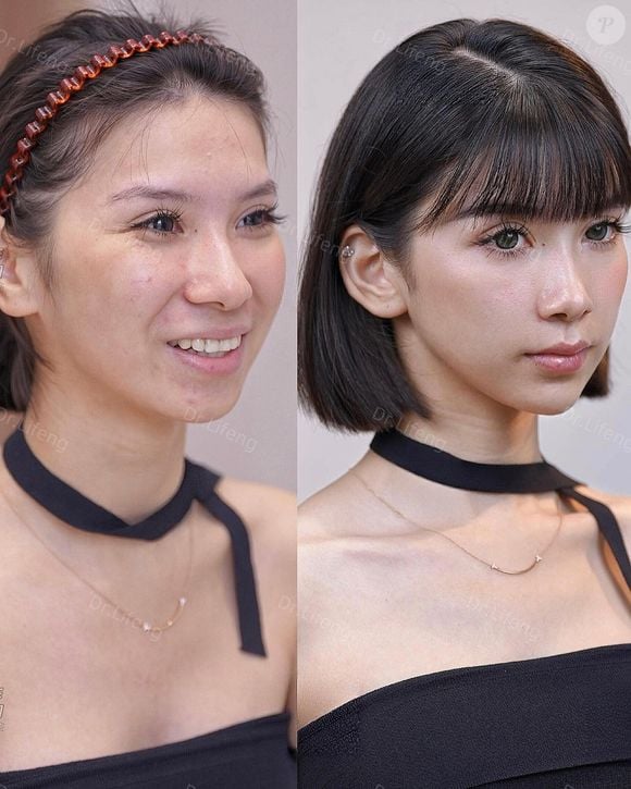Dr. Lifeng tem mais de 160 mil seguidores no Instagram, onde mostra os 'antes e depois'