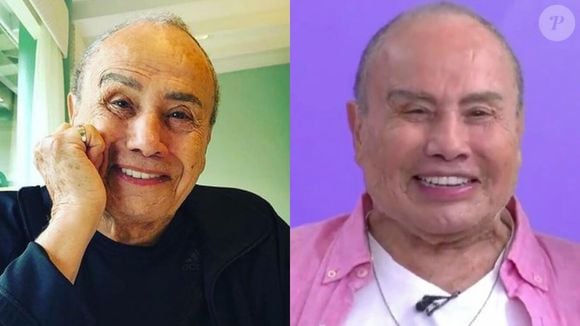 O que falar da harmonização facial do Stênio Garcia? O ator virou alvo de muitas piadas com o resultado publicado no 'Fofocalizando'