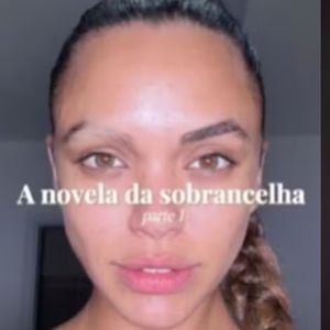 Calvície na sobrancelha: Giovana Cordeiro, de 'Dona de Mim', revela diagnóstico incomum por uso de muita química nos pelos; dermatologista explica