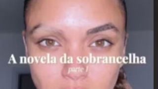 Calvície na sobrancelha: Giovana Cordeiro, de 'Dona de Mim', revela diagnóstico incomum por uso de muita química nos pelos; dermatologista explica
