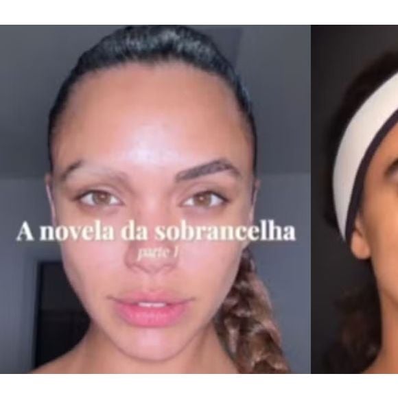 Calvície na sobrancelha: Giovana Cordeiro, de 'Dona de Mim', revela diagnóstico incomum por uso de muita química nos pelos; dermatologista explica